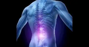 Presence of inflammatory back pain features found to be associated with the diagnosis of spondyloarthritis