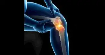 High mortality in painful knee osteoarthritis according to a community-based cohort study