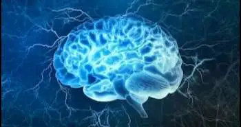 Migraine and non-migraine headaches following diagnostic catheter-based cerebral angiography