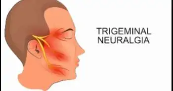 Impaired trigeminal nociception inhibition may be responsible for migraine headaches