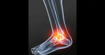 Ghrelin may emerge as a novel candidate to delay ankle post-traumatic osteoarthritis (PTOA) progression