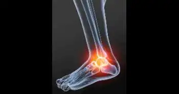 Ankle Joint Control appears as protective strategy to limit frontal plane ankle joint loading in potentially harmful situations.