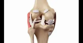 ACL reconstruction surgery-related risk factors found to be non-modifiable