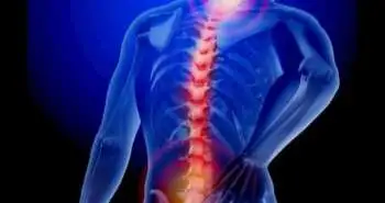 Novel treatment method for acute pain after cervical myelopathy surgery