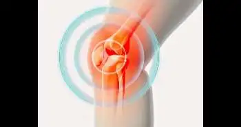 C-RFA found to benefit patients with chronic knee pain