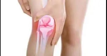 Revised Total Knee Arthroplasty with Total Knee Arthroplasty for stiff knee