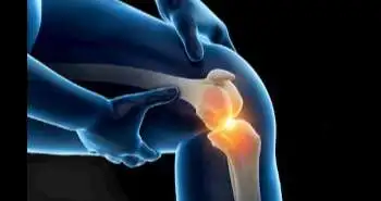 Arthroscopic knee debridement found to offer symptomatic relief in degenerative knees