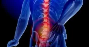 Scientists studied different patterns of spinal kinematics in NSCLBP patients