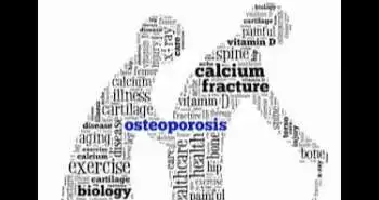 Relationship between oral glucocorticoid use and risk of osteonecrosis