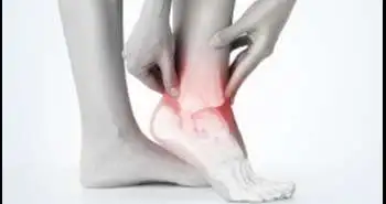 Patient history and physical examination after ankle sprain may help predict osteoarthritis