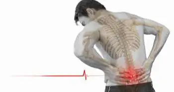 Effect of Radiofrequency Denervation on pain intensity among patients with chronic low back pain