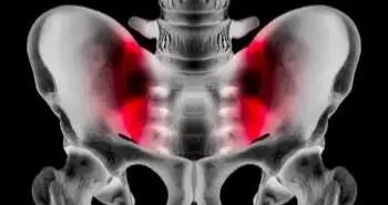 Ignoring the sacroiliac joint in chronic low back pain is costly
