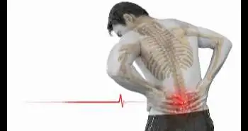 Conditioned pain modulation in patients with acute and chronic low back pain