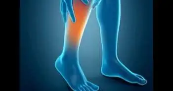 Effects of topical Diclofenac plus Heparin (Dhep+H plaster) on somatic pain sensitivity in healthy subjects with a latent algogenic condition of the lower limb