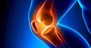 Lysophosphatidylcholines to phosphatidylcholines ratio predicts advanced knee osteoarthritis