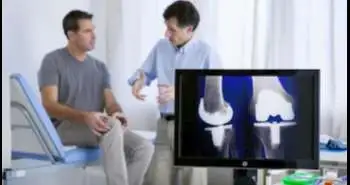 Long-term clinical results of unicompartmental knee arthroplasty in patients younger than 60 years of age: Minimum 10-year follow-up