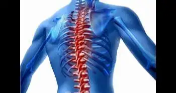 Pain improvement after lumbar spine surgery