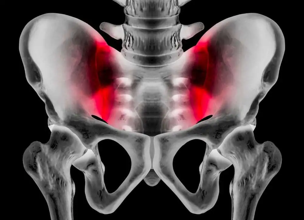 Данные МРТ о структурных повреждениях крестцово-подвздошных суставов можно использовать для классификации пациентов согласно критериям ASAS для аксиального спондилоартрита
