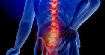 Study evaluates effect of spinal cord stimulation on low back pain of neuropathic origin