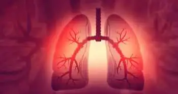 Lung injury induced by COVID-19 can be minimized by nintedanib, study finds!