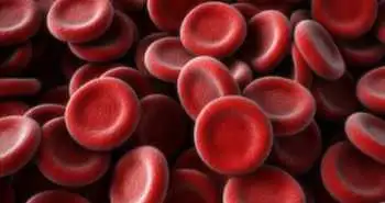 Guidelines for management of iron deficiency anemia during pregnancy