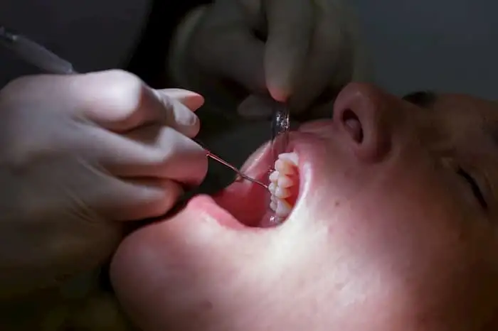dental.pain