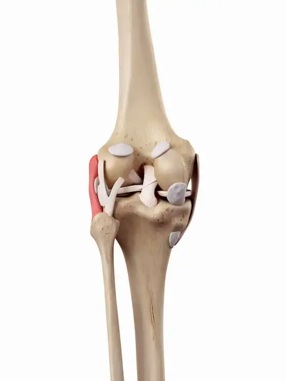 тотальная артропластика коленного сустава