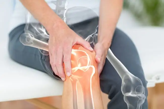 артропластика коленного сустава