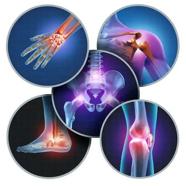 Стронция ранелат как потенциальный новый препарат для лечения остеоартрита