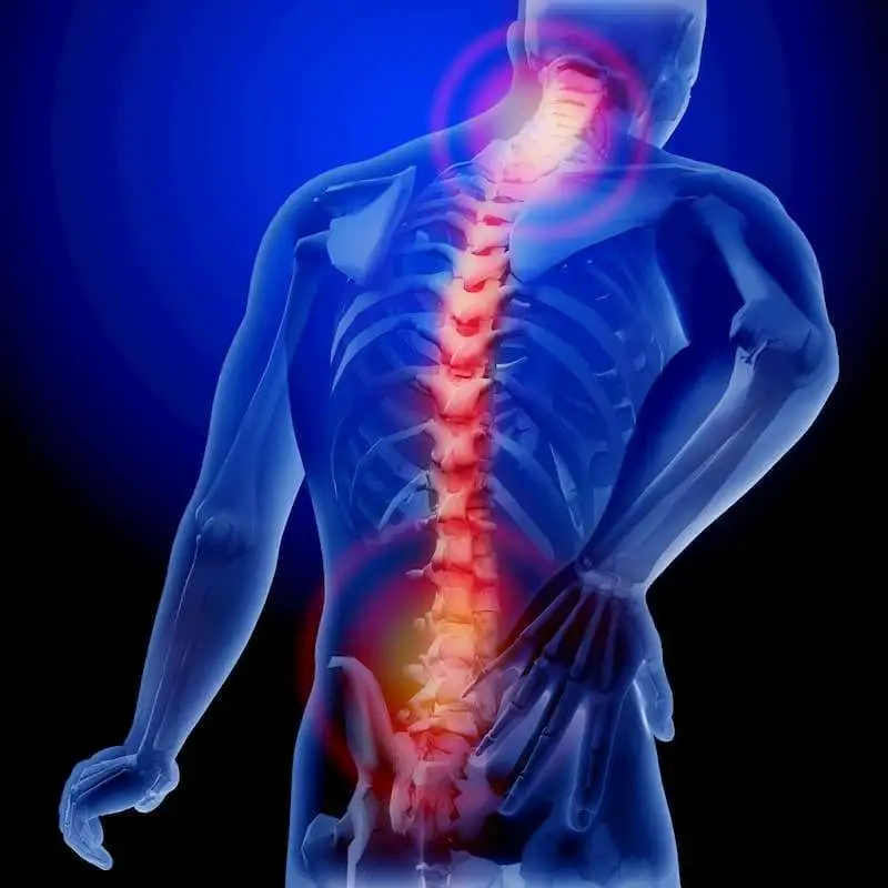 Status of back pain and axial spondyloarthropathy in hidradenitis suppurativa patients