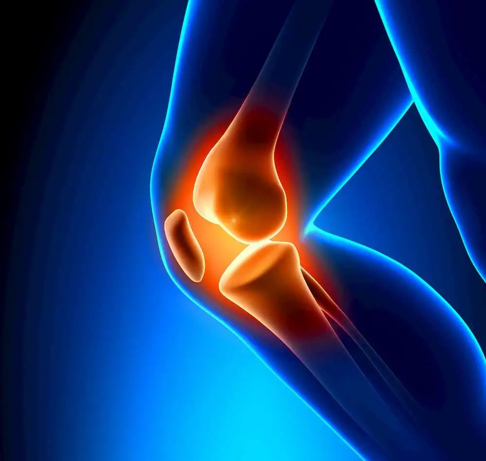 Влияние пищевых добавок, содержащих неденатурированный коллаген II типа, на симптомы остеоартроза коленного сустава