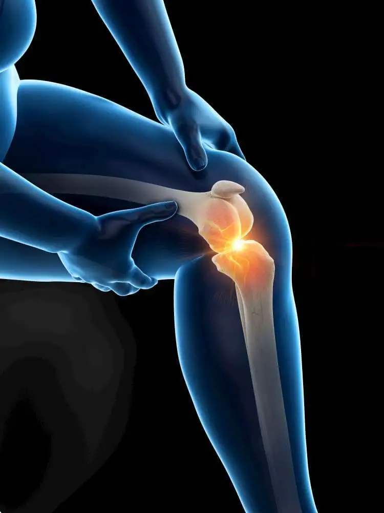 Ультразвуковая диагностика патологических изменений синовиальной оболочки, вызванных остеоартритом коленного сустава