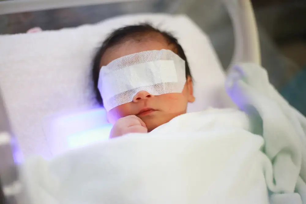 Neonatal jaundice