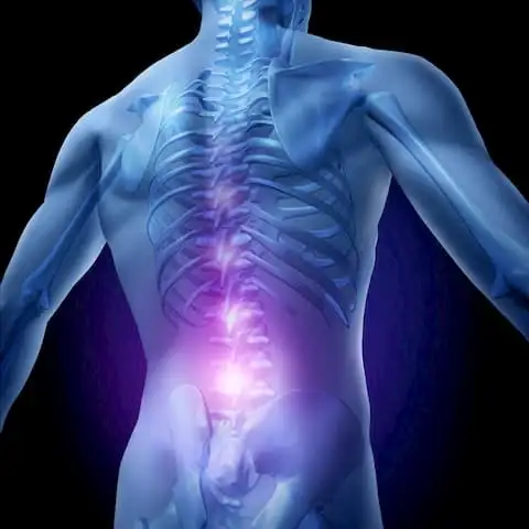 Chronic low back pain