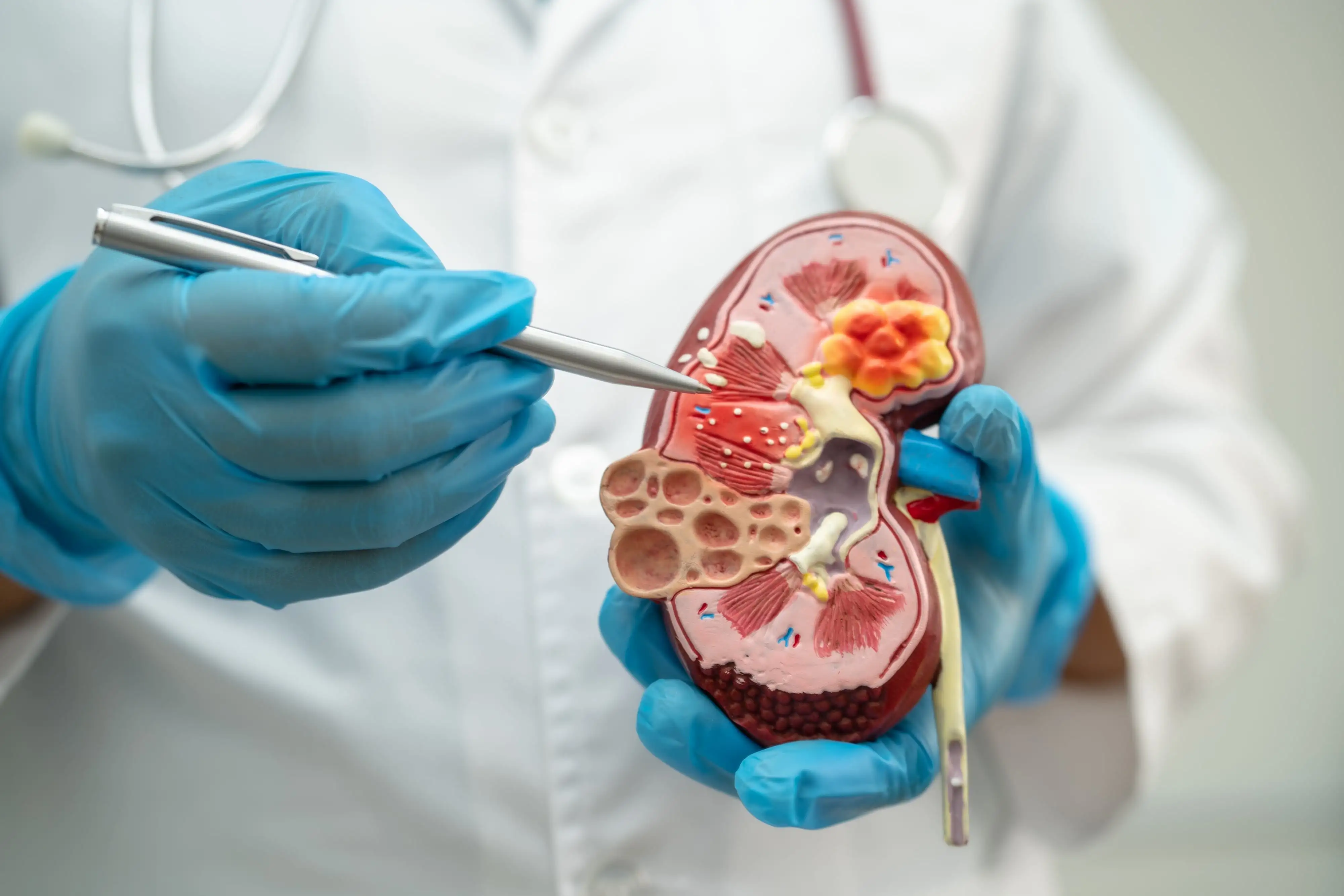 Renal impairment