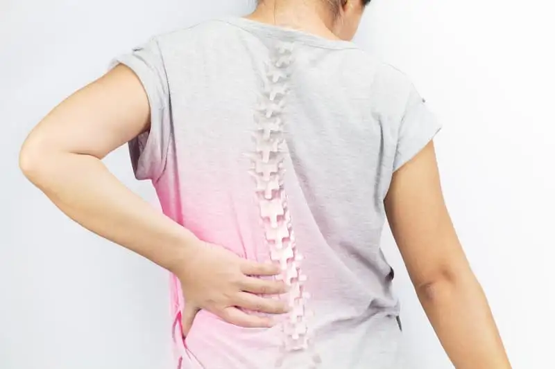 Ankylosing spondylitis