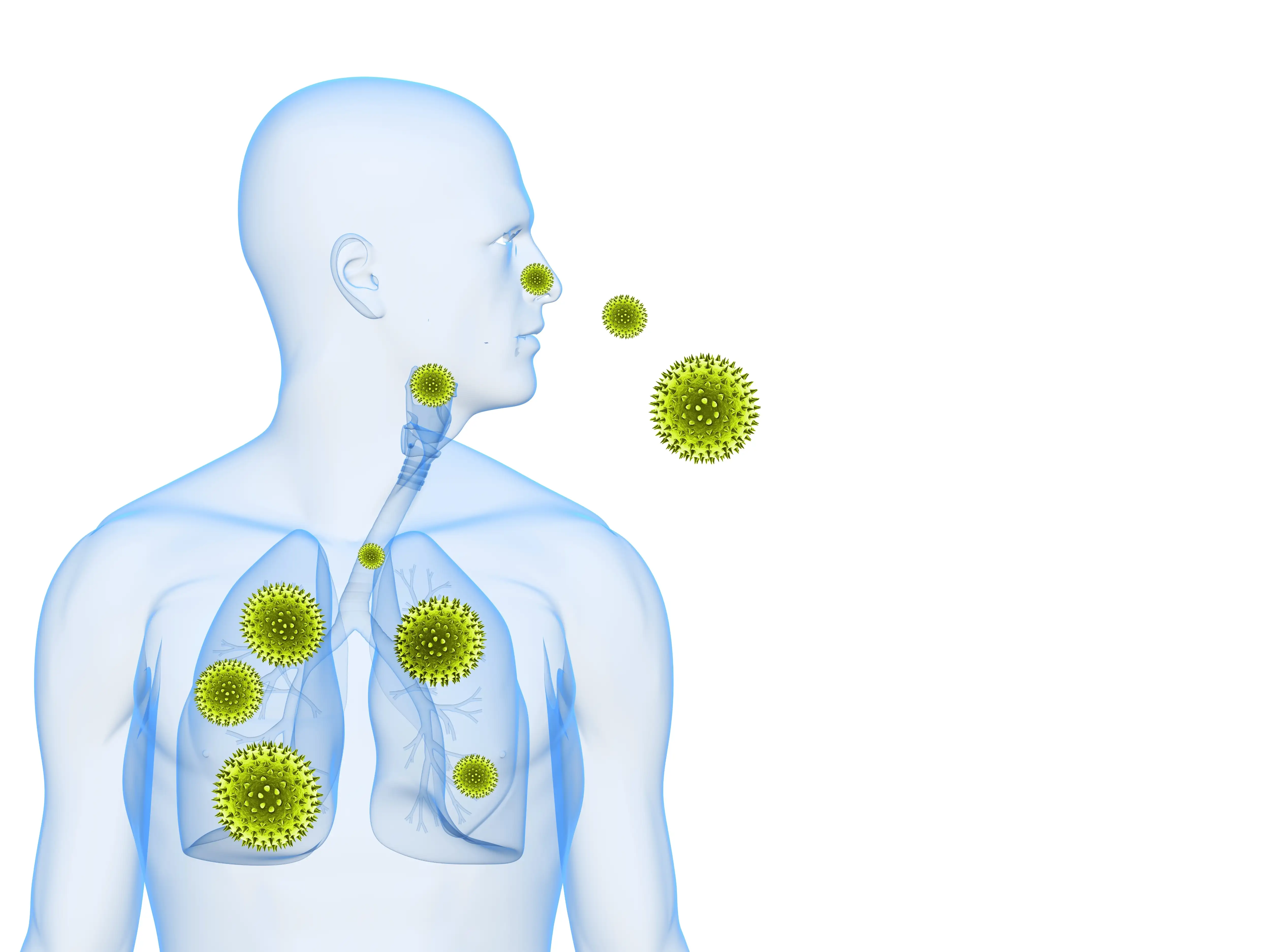 Respiratory syncytial virus infection